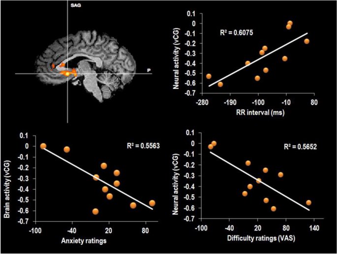 iiKlemm's tweet photo. Competitive gamers: stimulants + low hydration = anxiety

Most stimulants are diuretics:
↑ urination = ↑ dehydration risk

Just a ~0.5% water loss:
↑ Anxiety
↑ Perceived difficulty
↓ Mood

If you’re not drinking at least 2 litters of water daily, you’re throwing my elo. https://t.co/zTNlPGasGh