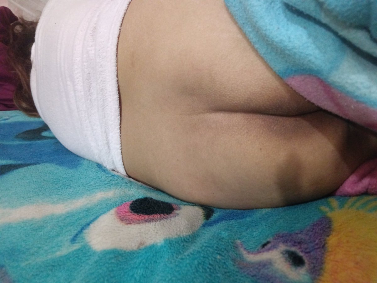 mi esposa la PELUDA de puebla tweet media