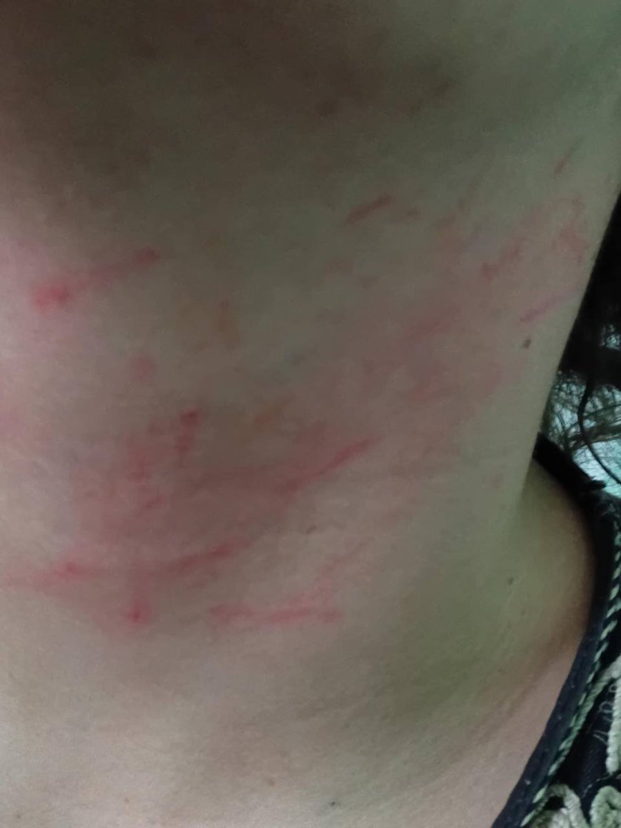 Témoignage glaçant de violences policières commises par la police municipale de Neuilly-sur-Marne.

Un enfant de 14 ans, frappé, plaqué au sol, étranglé, jusqu’à présenter des marques de strangulation.

Des violences policières inacceptables.

Soutien à l’enfant et à ses proches.
