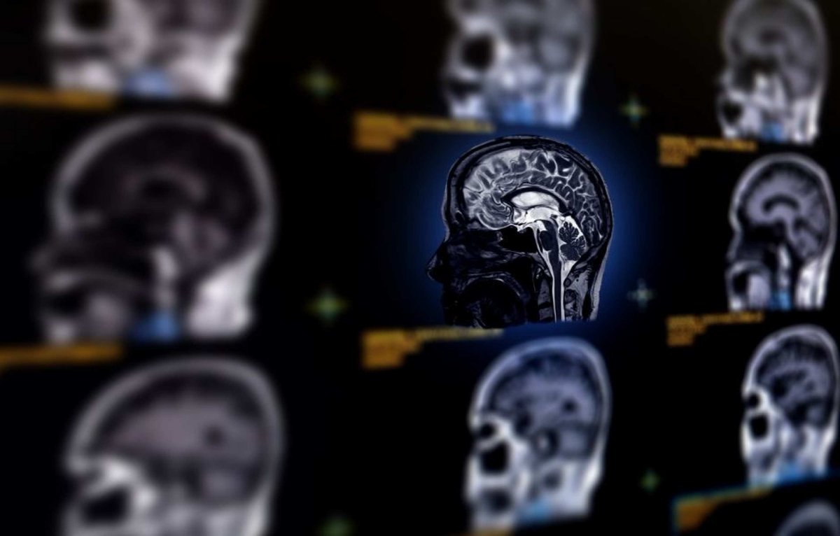 Sydney_CRF's tweet photo. Scientists develop a new PET tracer that can latch onto oxytocin receptors in living animals – paving the way for future studies in humans that may help researchers see how the ‘love hormone’ works in the brain and body, improving insights into social behaviour and mental health. 

Via Australian National Total Body PET Facility, a partnership between Sydney Imaging – a #USYD Core Research Facility – the National Imaging Facility, and the Northern Sydney Local Health District.

See Brain and Mind Centre news story 👉 https://t.co/hTNPESglKQ

𝗔𝗯𝗼𝘂𝘁 𝗦𝘆𝗱𝗻𝗲𝘆 𝗜𝗺𝗮𝗴𝗶𝗻𝗴 ➡️ https://t.co/wIqYRlKQQ2

@NIFAus @BrainMind_Usyd #PETTracer #Oxytocin #Neuroscience #MentalHealth
