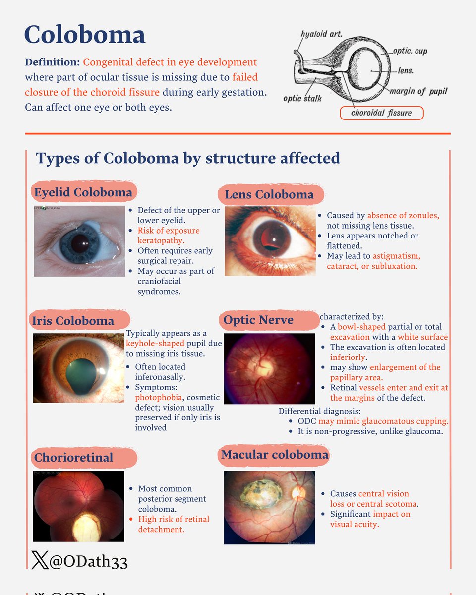Coloboma