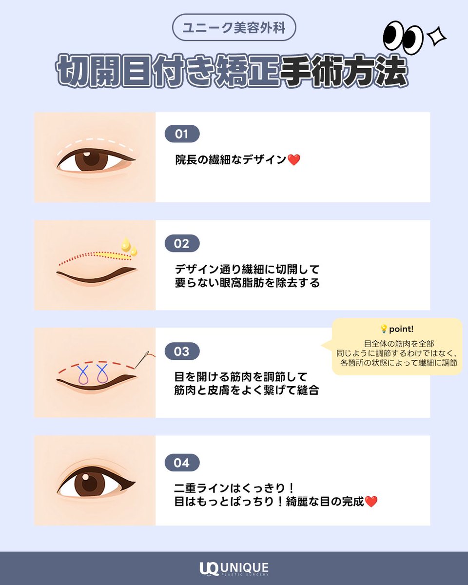 unique__jp's tweet image. 目の開きを改善する
#目つき矯正

ユニークの目つき矯正の手術方法は画像をチェック✔️

細かい作業と筋肉の配置を考慮しながら繊細な技術で安全で満足できる結果を生み出します🥰

質問、ご予約は公式LINEまで🩵
▶️ line.me/ti/p/ASaI14sy4x

#二重整形 #眠そうな目