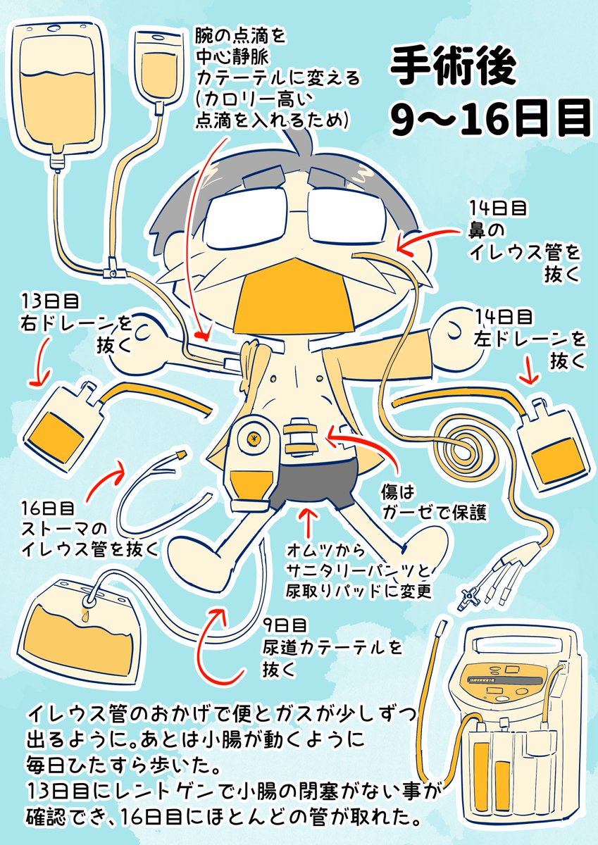 大腸全摘した時のはなし(3/5) 