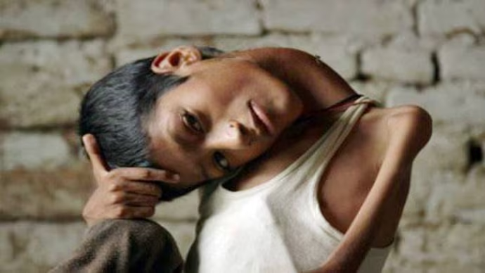 FrogKiller tweet media