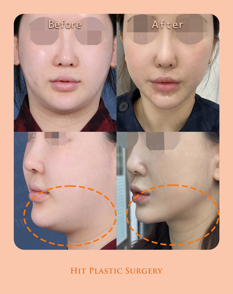 ヒット整形外科 tweet media