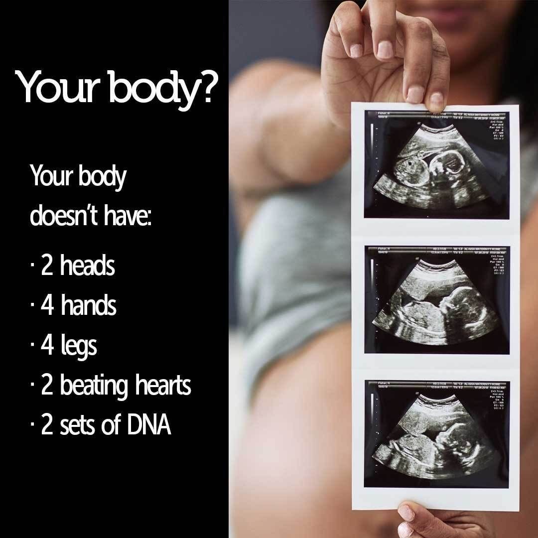 StevenErtelt's tweet image. 