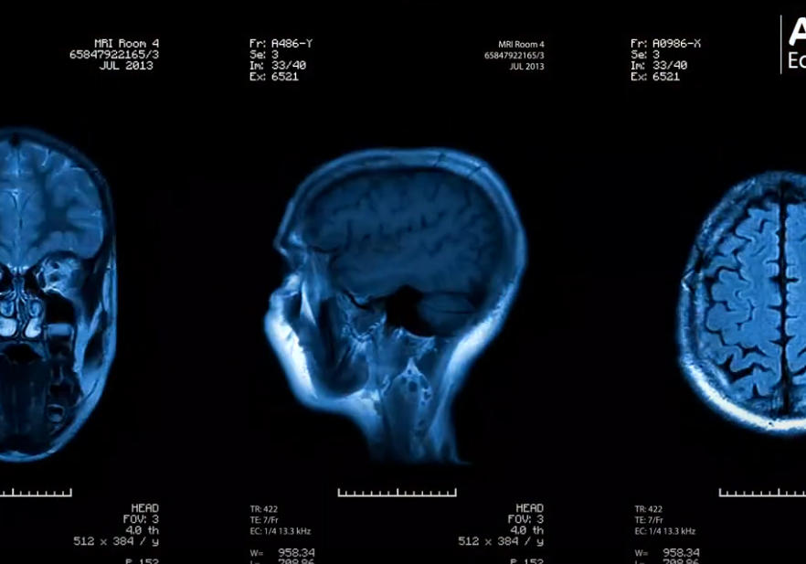 Nuestro cerebro interpreta cómo sentimos y orienta nuestro pensamiento. Repetir experiencias positivas como la compasión o la gratitud ayuda a fortalecerlas. María Laorden, neuropsicóloga del <a href="/Equipo_Clinico/">Equipo Clínico Atam</a> nos enseña a potenciar nuestro bienestar 👇

i.mtr.cool/xzgpzwioek