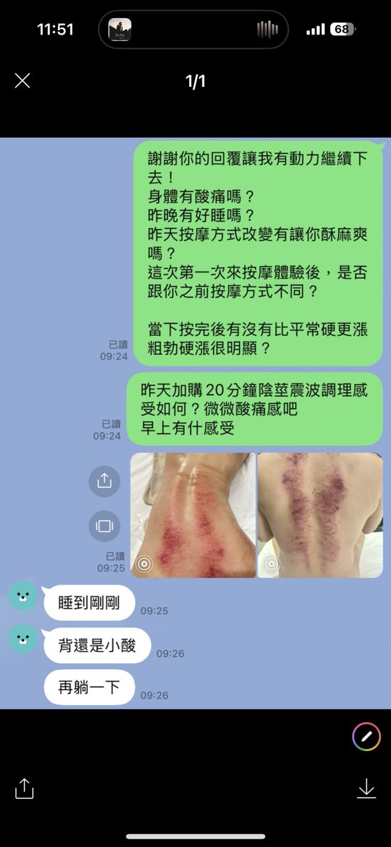 eff09333's tweet image. 謝謝台北來按摩你加購低震波課程，我懂心裡壓力讓你無法升旗典禮開始，期待這次做完後看效果如何？
其實身體壓力真的很大，心情抒發確實要說別放在心裡？
不然出痧永遠中心肺狀態很明顯，如果真的心情不開心也可以找我聊一下？
總是會有人聽見你的聲音。…
