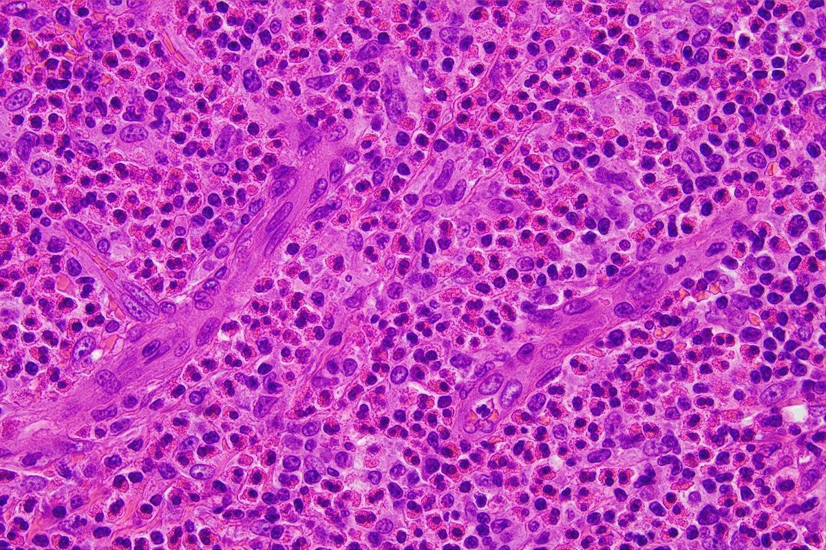 Pathology Walker@Auto Tweet Bot tweet media