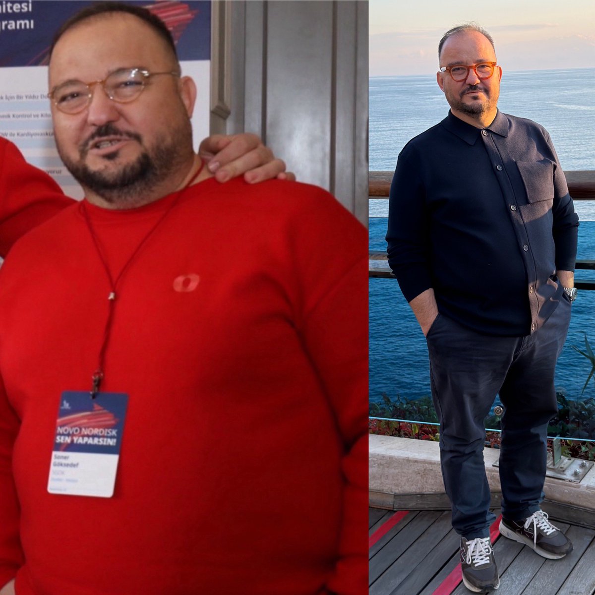 Snrgksdf's tweet photo. @dgoksedef Nasıl 🤪 https://t.co/ueZnpA9X7O
