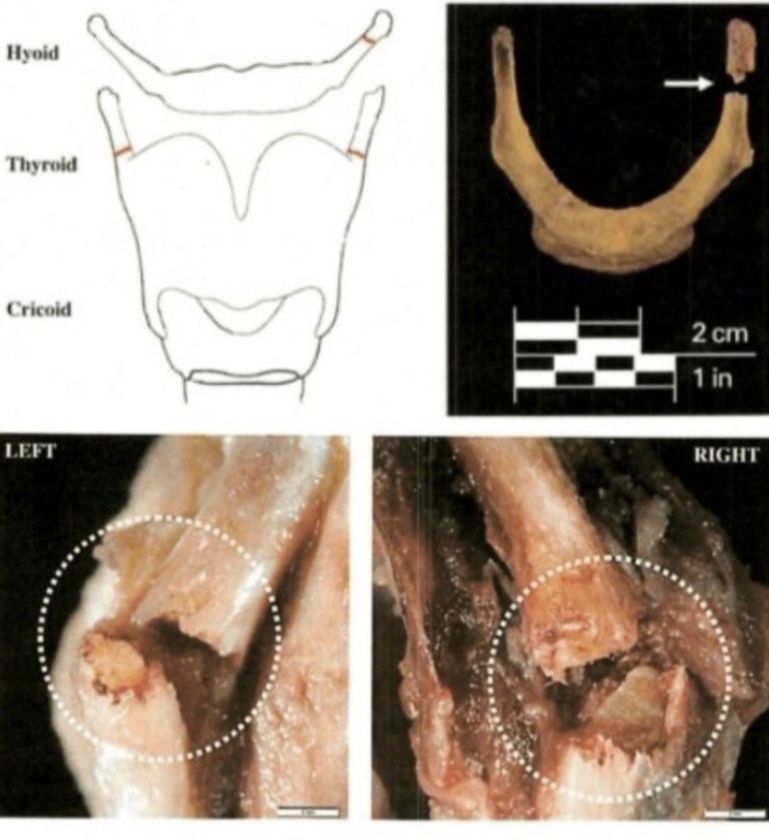 Matt Wallace tweet media