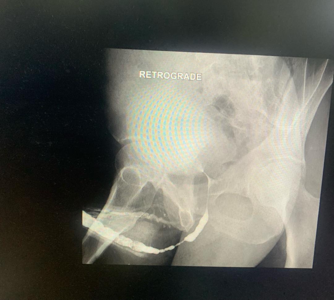 Theo Ndanga Ndayishimye tweet media