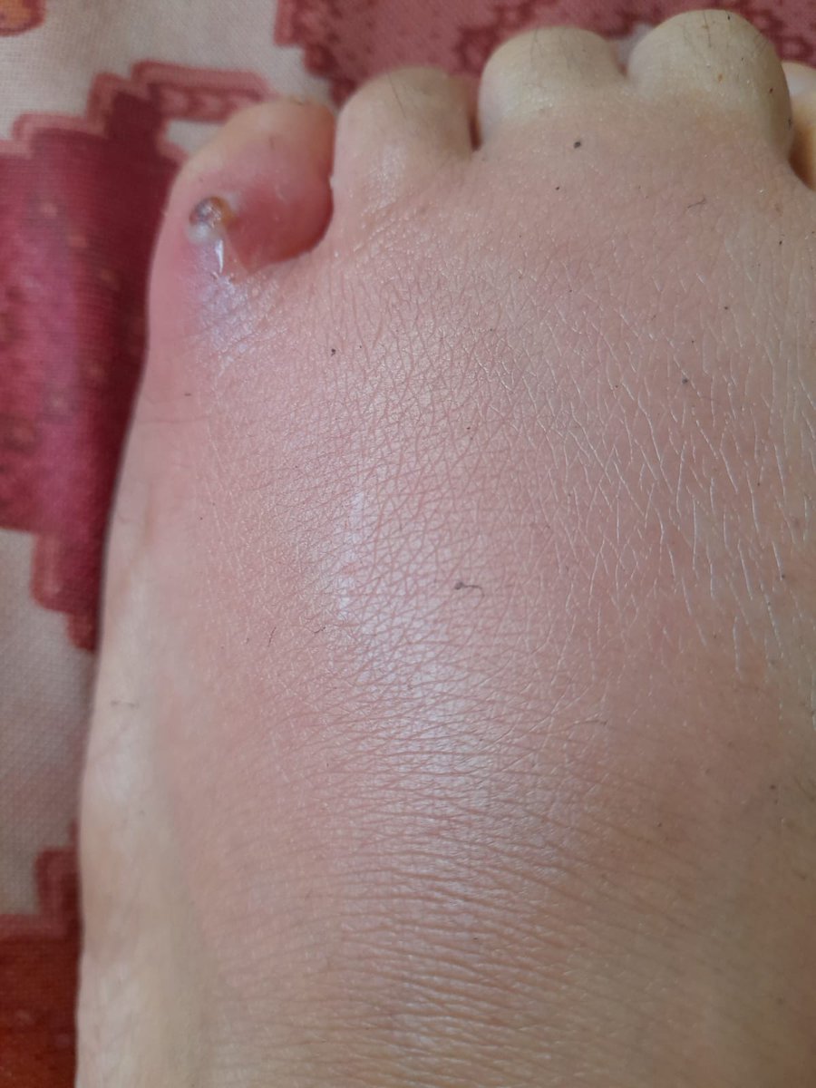 DalulainGaza's tweet image. 😴😔We live in tents on the streets, surrounded by garbage and germs. We are exposed to dangerous and harmful insects. Please help me, donate so I can move to a safer place. Please don't ignore me. 
🙏🙏

chuffed.org/project/138194…