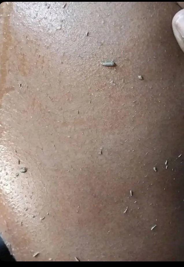 Her banyo yaptığımda cildimden bu parçacıkların döküldüğünü fark ediyorum. Endişelenmeli miyim ?