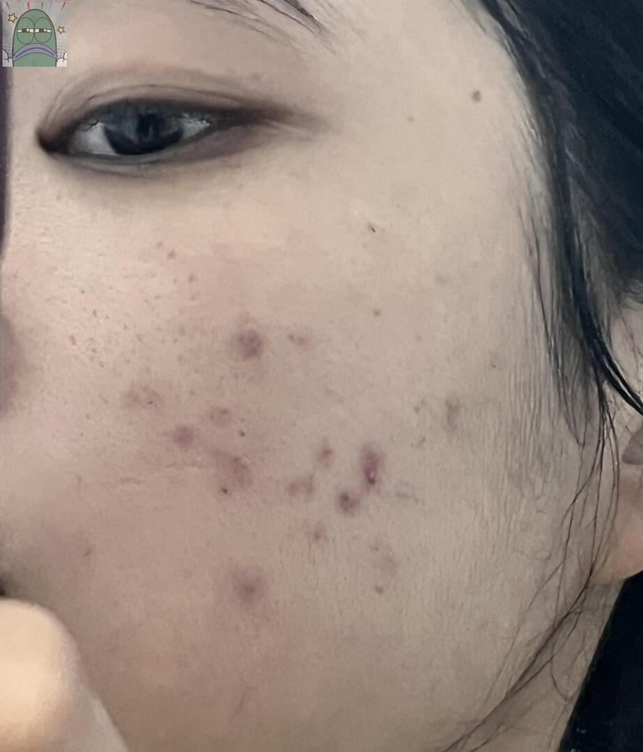 Tanyarlfes tweet media