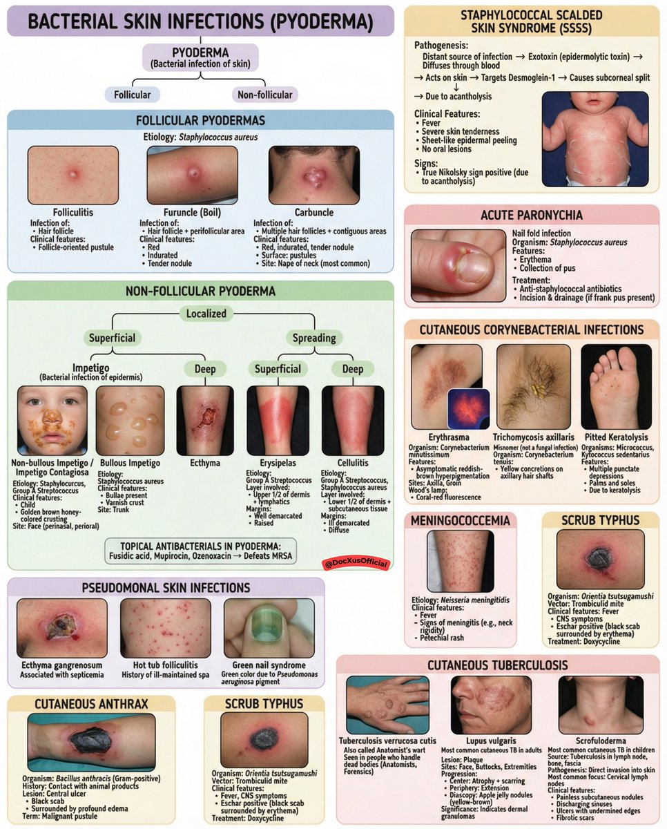 docxusofficial's tweet photo. Bacterial Skin Infections - Simplified https://t.co/cojaPGvpV2