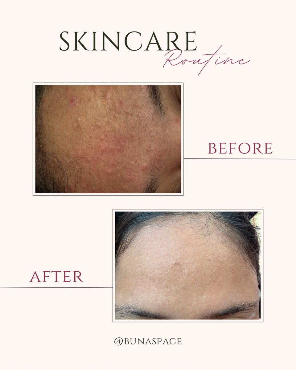 bu-na 姊姊 🌸 tweet media