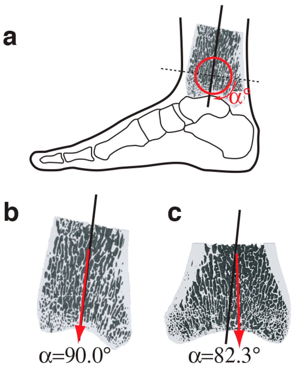 Bioeng_MDPI's tweet photo. 💥Highly recommended publication: "Cortical and Trabecular Bone Modeling and Implications for Bone Functional Adaptation in the Mammalian Tibia"
🔗https://t.co/Dz7vgwebl9
📌#BoneModeling #Tibia #BoneBiology #MedTech https://t.co/iA3BVnM6Uu