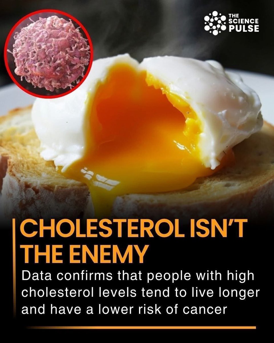 argosaki's tweet photo. New research is challenging everything we thought about cholesterol. Data now confirms that people with higher cholesterol levels may actually live longer and have a lower risk of developing cancer. While high cholesterol has long been linked to heart disease, these latest studies reveal a surprising protective effect in other areas of health.
Scientists suggest that cholesterol plays a crucial role in cell repair, hormone production, and maintaining the immune system. It may help the body fight off certain types of cancer and support longevity in ways we’re only beginning to understand. This doesn’t mean cholesterol is entirely risk-free, but it highlights the importance of a balanced perspective rather than fearing it outright.
For years, low cholesterol was considered the ultimate goal, but the evidence shows that moderately higher levels could be linked to better long-term health outcomes. As science continues to explore this fascinating connection, it could reshape the way we approach diet, medicine, and preventive health.
#TheSciencePulse #HealthFacts #CholesterolTruth #Longevity