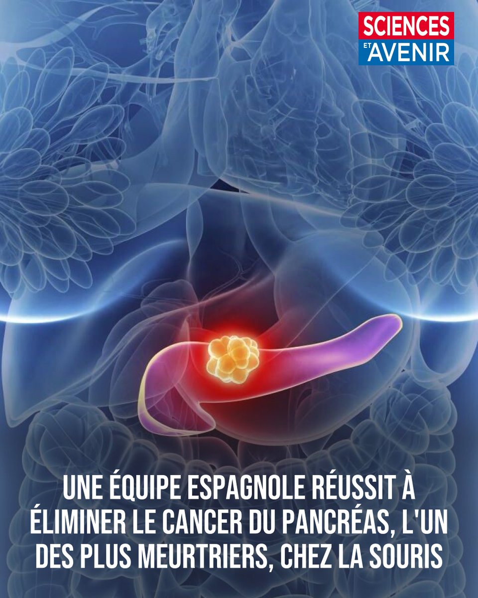 Sciences_Avenir's tweet image. Le cancer du pancréas est l'un des plus meurtriers, avec un taux de survie à 5 ans d’à peine 5%

"Non seulement la tumeur disparaît, mais elle ne réapparaît pas, au moins pendant 200 jours, ce qui correspond à peu près au quart de la vie d'une souris !"
👉 l.sciencesetavenir.fr/Gdx