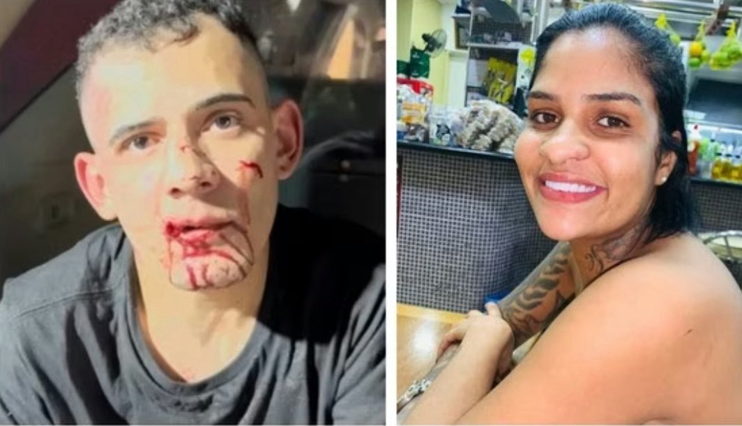 O cão Orelha e a mulher amputada

Por que uma multidão se mobilizou pelo cão orelha na av, Paulista e não fez o mesmo pela jovem arrastada por um carro que teve as pernas amputadas e depois morreu??