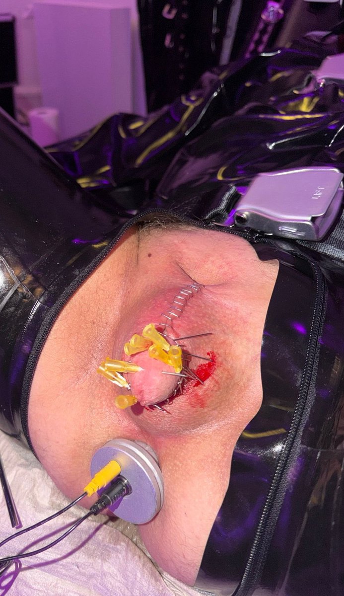 Es folgte eine intensive, aber dringend notwendige Behandlung der Clit und weiterer empfindlicher Stellen.
Nach einem ausgedehnten Tease &amp; Denial und ohne 💦 verschloss meine Herrin <a href="/LadyLexiBLN/">LadyLexi</a> den Sklavenschwanz wieder sicher im KG und nahm die Schlüssel an sich.
Danke Herrin!