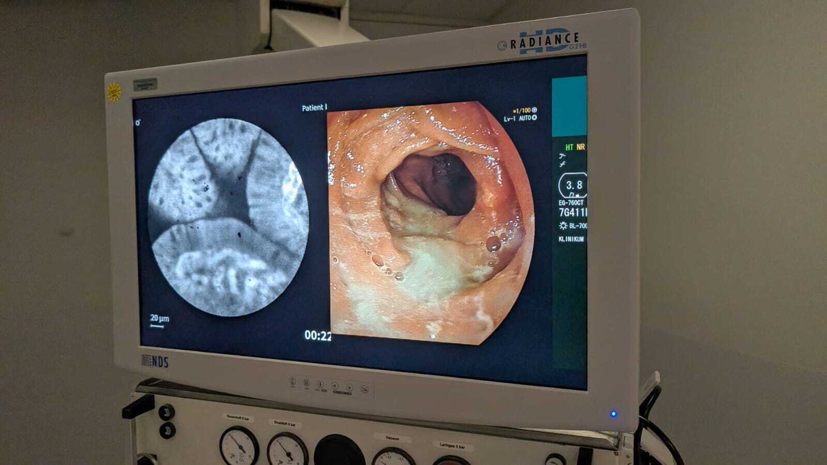 Cellvizio® by Mauna Kea Technologies tweet media