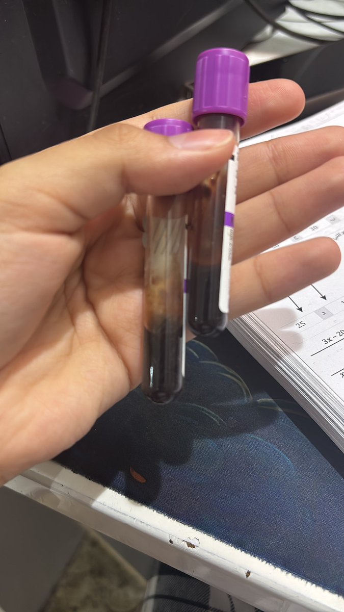 متخلفه عقليا tweet media