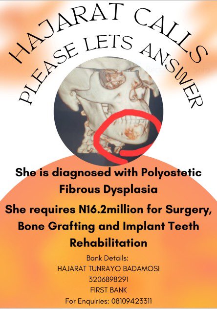 Owolabiyusuff's tweet photo. @Fmohnigeria @muhammadpate 

Pls help us sir…👇👇👇 https://t.co/LNS4HhgnWL