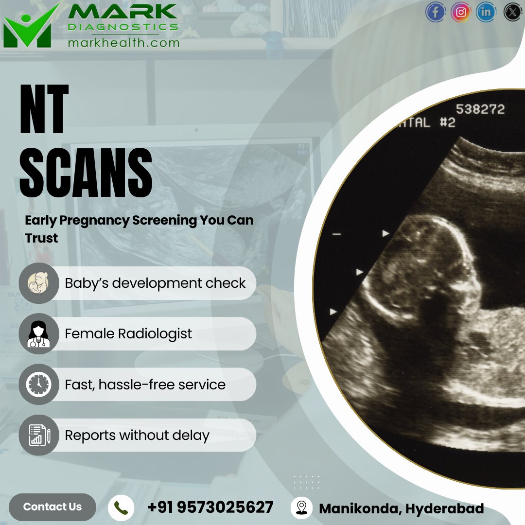 MarkDiagnostics's tweet image. Early pregnancy screening you can trust 🤍
NT Scans for baby’s development check
👩‍⚕️ Female Radiologist
⏱️ Fast &amp;amp; hassle-free
📄 Reports without delay
📍 Manikonda, Hyderabad
📞 +91 9573025627
#NTScan #EarlyPregnancyCare #Ultrasound #HealthyPregnancy #MarkDiagnostics