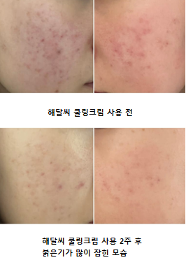 haedalsee's tweet photo. #RT이벤트

추첨을 통해서 5분께 해달씨 쿨링크림을 드려요.

요즘 피부 열감 때문에 예민한 분들 👀
해달씨 쿨링크림이 열감으로 인한 피부 불편 완화에 도움 될 수 있다는 내돈내산 후기가 있어요!
출처: gottagotowork님의 네이버 블로그

참여 방법:
🦦 해달씨 계정 팔로우
🔁 이 트윗 RT
(당첨자 발표: 2월 9일)

피부 열 오르면,
해달씨 먼저 찾게 되는 이유… 🦦🌊