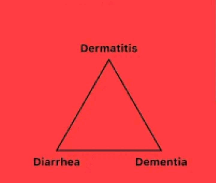 The TRIAD is called......