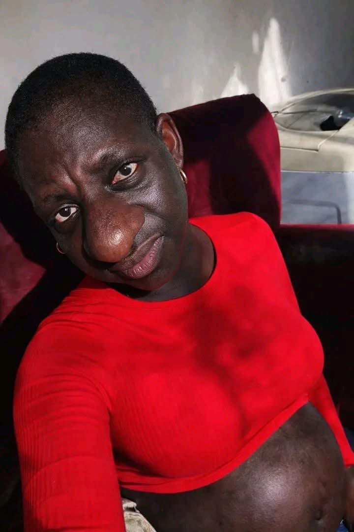 Before pregnancy🤰       After pregnancy 🤰 😭😭