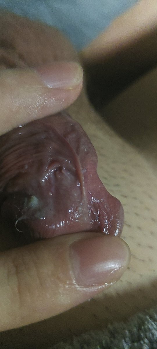 尖➕艾🔞🦠🥦 tweet media