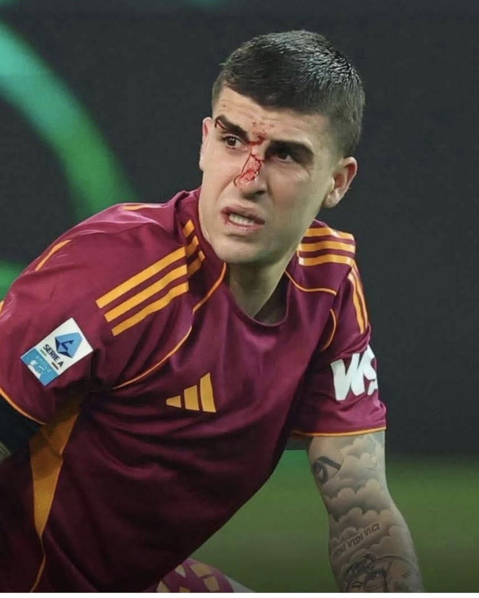 Robnassisi's tweet photo. #UdineseRoma #Mancini
Ha giocato con il naso fratturato e sanguinante. Ha rischiato di segnare nel finale e solo la bravura del portiere avversario gli ha negato il gol. Perché chi gli gioca vicino non comprende l’importanza di dare tutto dall’inizio senza poi avere rimpianti? https://t.co/xrJqxkNlVG