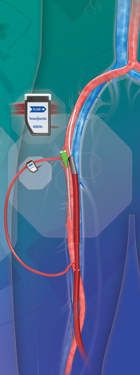 Transonic Systems tweet media