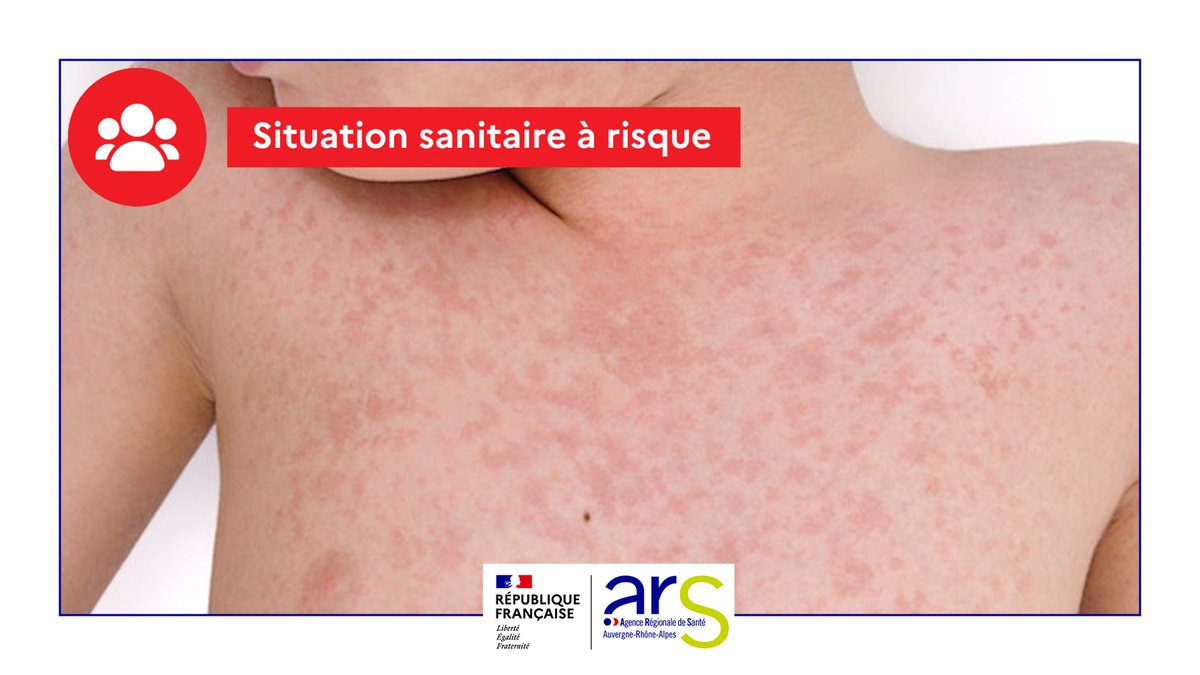 ARS Auvergne-Rhône-Alpes tweet media