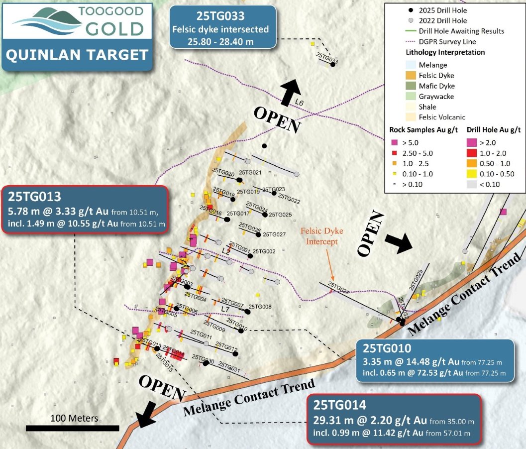 NextLevelOTC's tweet image. $TGGCF 2025 drilling at Toogood materially expanded the mineralized felsic dyke (down-dip +100%, strike +75%) and confirmed the Mélange Contact as a district-scale gold-bearing trend that extends for more than 15 km across the Toogood Gold Project.