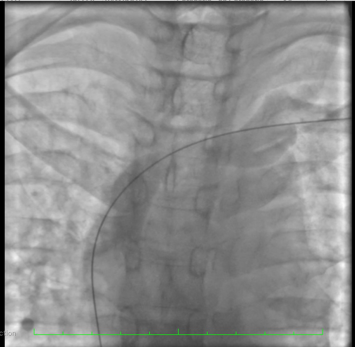 Nestor Mahurkalibur tweet media