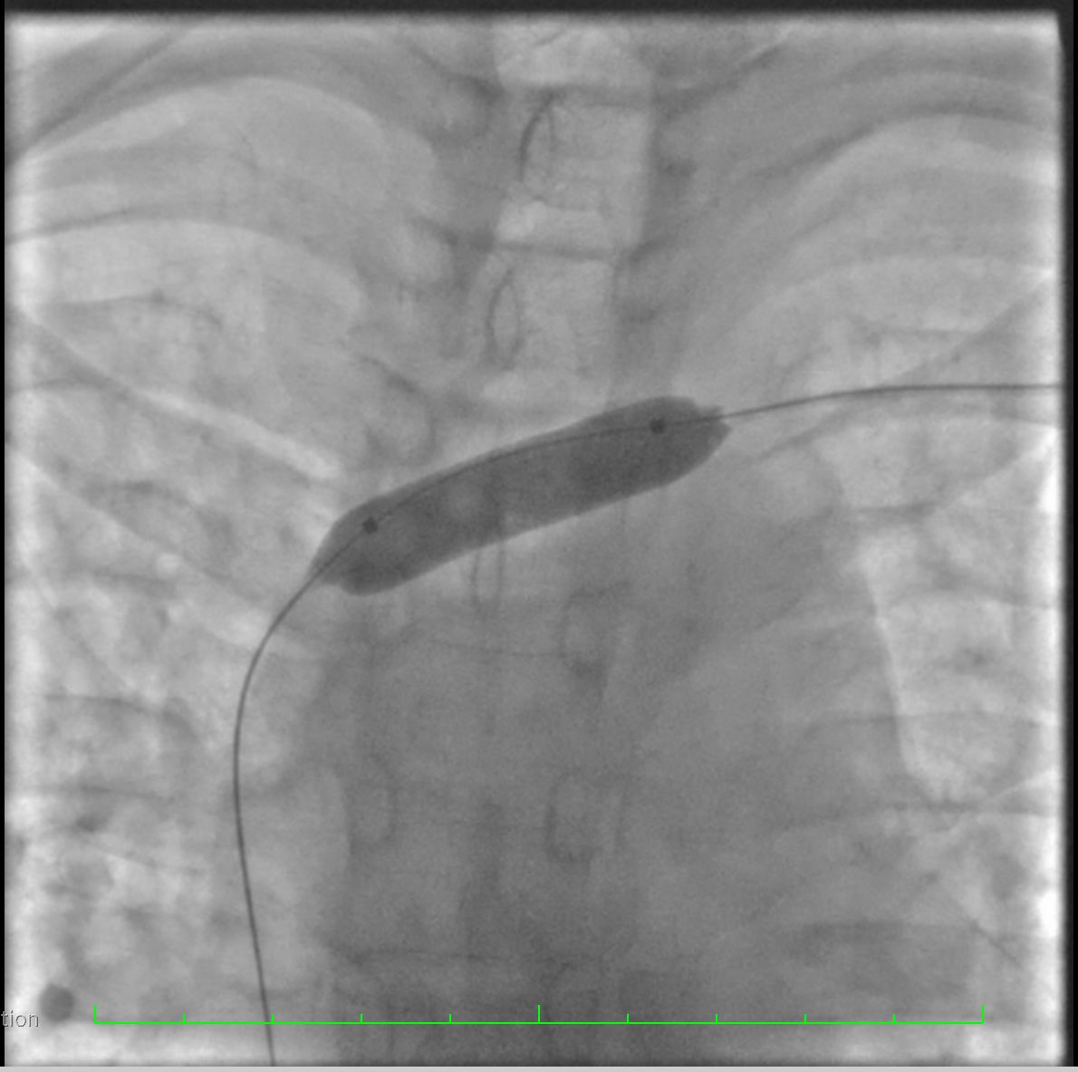 Nestor Mahurkalibur tweet media