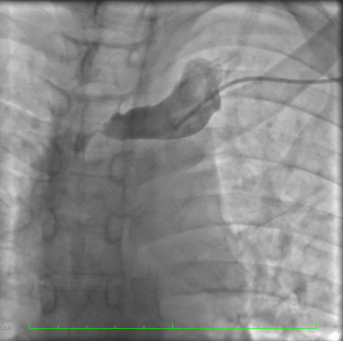 Nestor Mahurkalibur tweet media