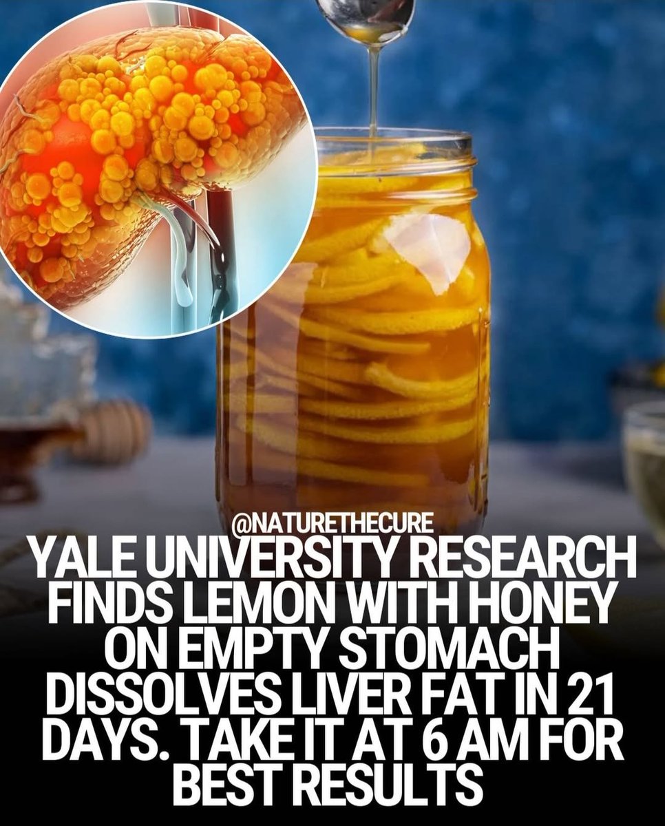 gymsociety's tweet photo. LEMON + HONEY MORNING RITUAL 🍋 🍯 https://t.co/P6cDYcQyzj