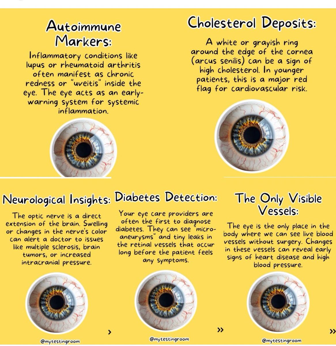 #repost @mytestingroom a great summary of Why Eye Exams can detect more than Vision Problems! 

This is why retinal imaging and dilated full comprehensive eye examinations are so important to explore systemic health. 

Book online 💻 email 📧 or by phone 📱