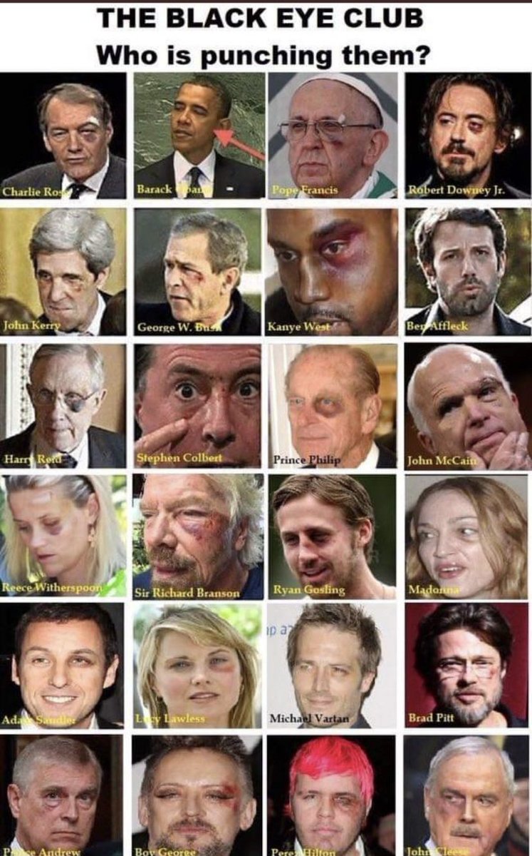 tolgaozcelkk90's tweet photo. PANDA GÖZÜ
SHARON STONE
❗ KAYIP KAÇIRILAN KURBAN ÇOCUKLAR❗
"Kara Göz" ve "Panda Eye" Adrenochrome eksikliği.
#pandaeye #GRAMMYs #EpsteinFiles #GRAMMYs2026 #Adrenachrome https://t.co/OEVqHiWCD5