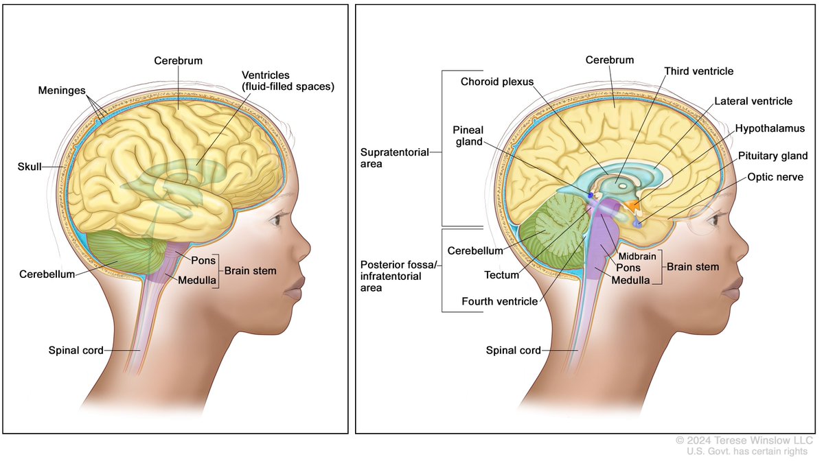 CCOS_CTSA's tweet photo. A K12 awardee @ICTSIowa is advancing new treatment strategies for diffuse intrinsic pontine glioma (DIPG), a rare pediatric brain cancer with an urgent unmet need. 
This work reflects the #CTSAProgram commitment to translation and engagement. Read more: https://t.co/YuIb2TB3SV https://t.co/Rh02L2zEtt