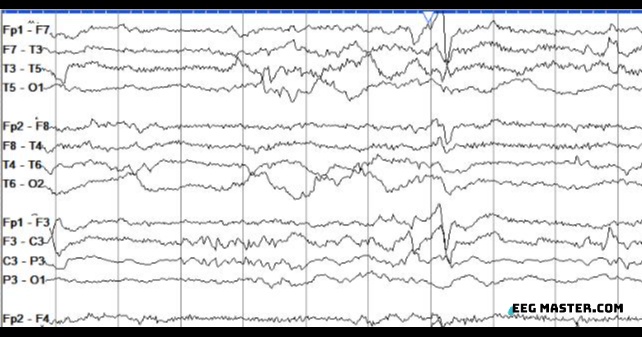 EEG Master tweet media