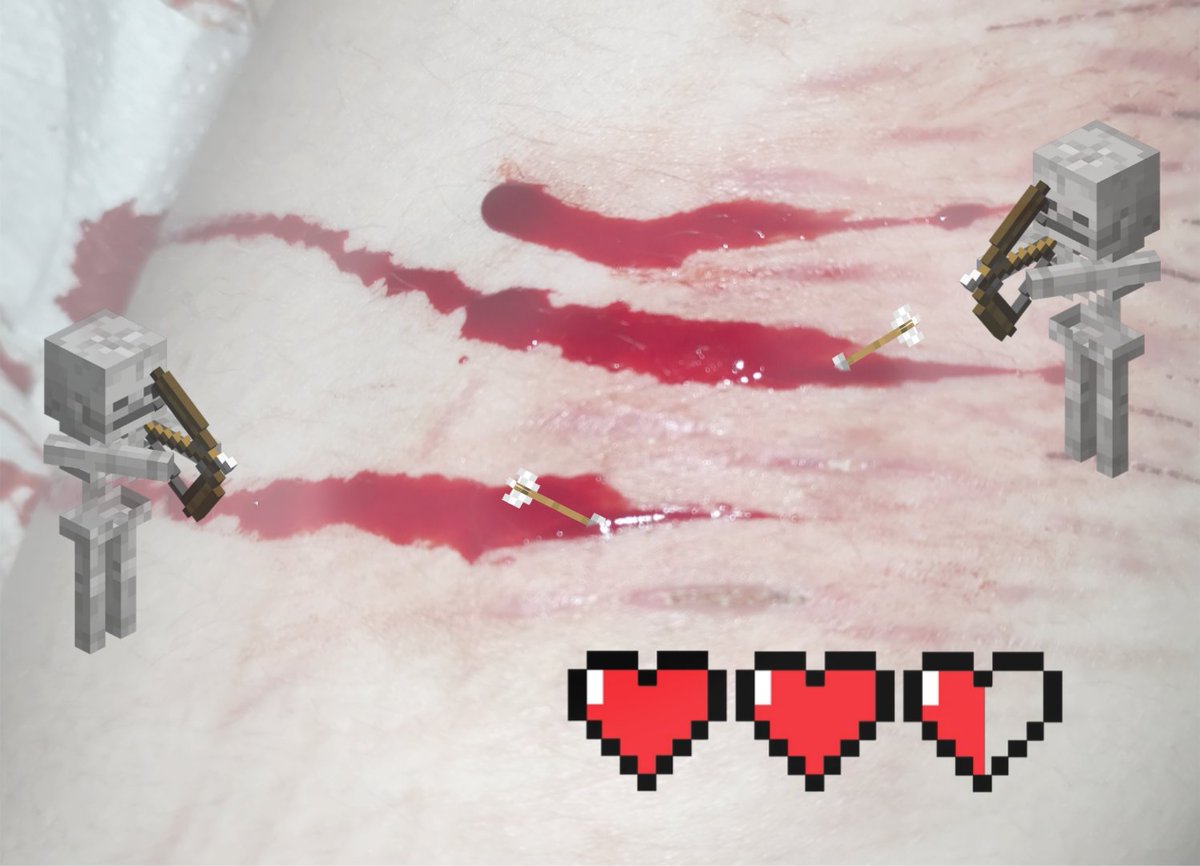 fartfieldXD's tweet photo. AAAA THEY SHOT ME TO STYRO https://t.co/gJNo22ezJt