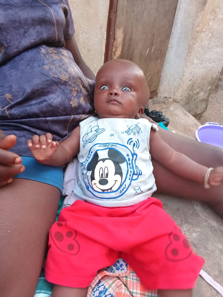 bonesmantv's tweet image. This might be my last post about Theodora. 
We were only able to raise Ghc3,000 out of the GHc30,000 for the 5 months Old Theodora Sam. We are now left with GHc27,000 to go. 
Her condition keeps getting worse and needs an urgent treatment. 
Abusua let’s come together to help save…