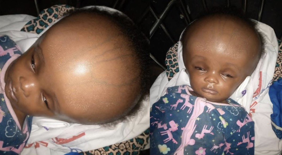 bonesmantv's tweet image. This might be my last post about Theodora. 
We were only able to raise Ghc3,000 out of the GHc30,000 for the 5 months Old Theodora Sam. We are now left with GHc27,000 to go. 
Her condition keeps getting worse and needs an urgent treatment. 
Abusua let’s come together to help save…