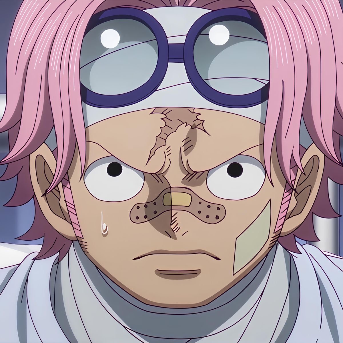 peronyawns's tweet image. rhinoplasty, cheek implants, jaw shave, chin reduction, face lift, blepharoplasty, buccal fat removal, botox, eye lift, cheek filler